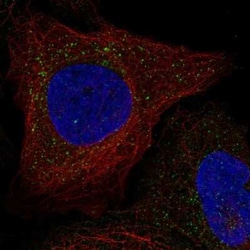 WBSCR28 Antibody, Novus Biologicals 25ul; Unconjugated:Antibodies, Polyclonal