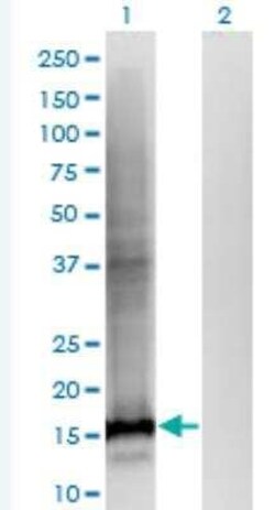 WDHD1 Antibody (2F10), Novus Biologicals 100 &mu;g | Buy Online | Novus Biologicals | Fisher Scientific