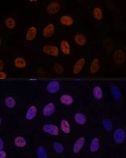 WDHD1 Antibody - Azide and BSA Free, Novus Biologicals 0.02 mL; Unconjugated:Antibodies,