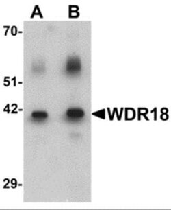 WDR18 Antibody - BSA Free, Novus Biologicals 0.1 mg; Unconjugated:Antibodies,