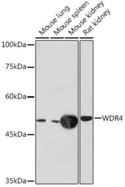 WDR4 Rabbit anti-Human, Mouse, Rat, Clone: 5R7B6, Novus Biologicals 100