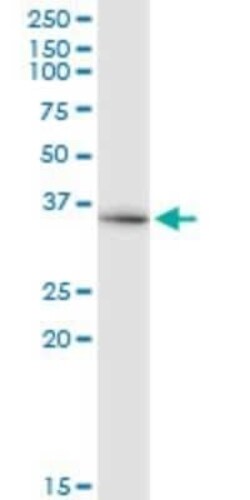 WDR42A Antibody (4G8), Novus Biologicals 0.1 mg | Buy Online | Novus Biologicals | Fisher Scientific