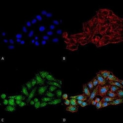 WDR45 Antibody, Novus Biologicals 100 &mu;g; Unconjugated:Antibodies, Polyclonal