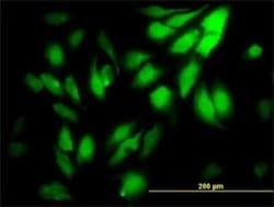 WDR5 Antibody (2C2), Novus Biologicals 0.1 mg, Unconjugated:Antibodies,