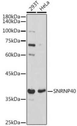 WDR57 Rabbit anti-Human, Mouse, Polyclonal, Novus Biologicals 20 &mu;g;