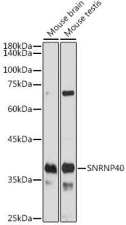 WDR57 Rabbit anti-Human, Mouse, Polyclonal, Novus Biologicals 20 &mu;g;