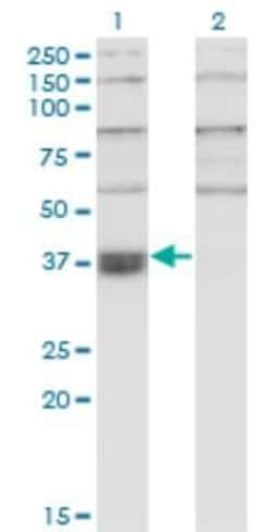 WDR58 Antibody (1F6), Novus Biologicals 0.1 mg; Unconjugated:Anticuerpos