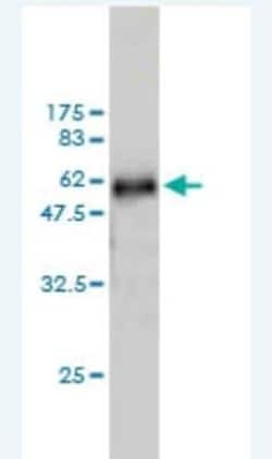 WDR6 Antibody (2D4), Novus Biologicals 0.1 mg; Unconjugated:Antibodies,