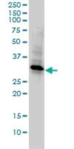 WDR61 Antibody (3E5-1A12), Novus Biologicals 0.1 mg | Buy Online | Novus Biologicals | Fisher Scientific