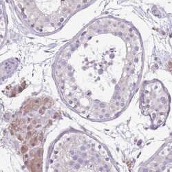 WDR70 Antibody, Novus Biologicals:Antibodies:Primary Antibodies