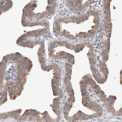 WDR77 Antibody, Novus Biologicals 25 &mu;L | Buy Online | Novus Biologicals | Fisher Scientific