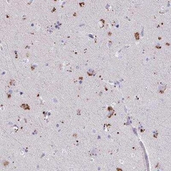 WDR97 Antibody, Novus Biologicals 25 &mu;L, Unconjugated:Antikörper