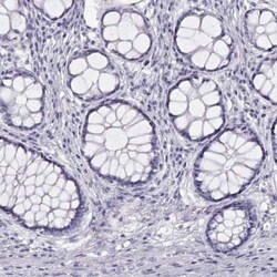 WFDC8 Antibody, Novus Biologicals:Antibodies:Primary Antibodies