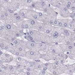 WFDC8 Antibody, Novus Biologicals:Antibodies:Primary Antibodies