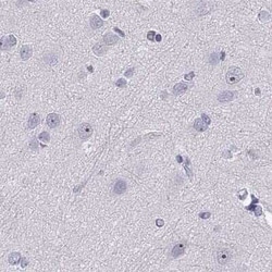 WFDC8 Antibody, Novus Biologicals:Antibodies:Primary Antibodies