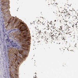 WFDC8 Antibody, Novus Biologicals 25ul; Unconjugated:Antibodies, Polyclonal