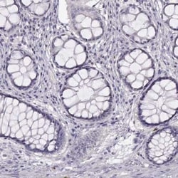 WFDC8 Antibody, Novus Biologicals 25ul; Unconjugated:Antibodies, Polyclonal