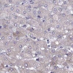 WFDC8 Antibody, Novus Biologicals 25ul; Unconjugated:Antibodies, Polyclonal
