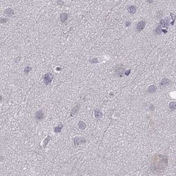WFDC8 Antibody, Novus Biologicals 25ul; Unconjugated:Antibodies, Polyclonal