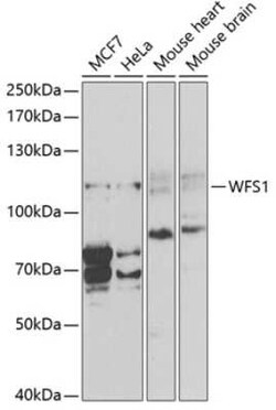 WFS1 Antibody - BSA Free, Novus Biologicals 0.1 mL; Unconjugated:Antibodies,