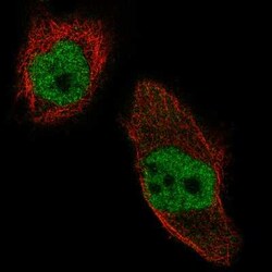 WHSC1 Antibody (CL1057), Novus Biologicals 0.1 mL, Unconjugated:Antibodies,