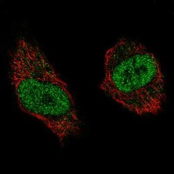 WHSC1 Antibody (CL1063), Novus Biologicals 25 &mu;L, Unconjugated:Antibodies,