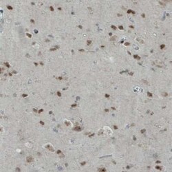 WHSC1 Antibody (CL1063), Novus Biologicals 25 &mu;L, Unconjugated:Antibodies,