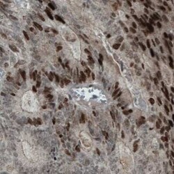 WHSC1 Antibody (CL1063), Novus Biologicals 25 &mu;L, Unconjugated:Antibodies,