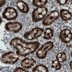 WHSC1 Antibody (CL1063), Novus Biologicals 25 &mu;L, Unconjugated:Antibodies,