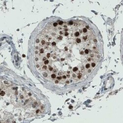 WHSC1 Antibody (CL1063), Novus Biologicals 25 &mu;L, Unconjugated:Antibodies,