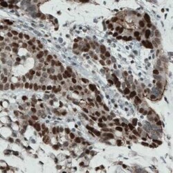 WHSC1 Antibody (CL1063), Novus Biologicals 25 &mu;L, Unconjugated:Antibodies,