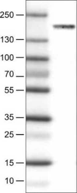 WHSC1 Antibody (CL1063), Novus Biologicals:Antibodies:Primary Antibodies