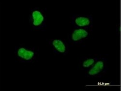 WHSC1 Antibody, Novus Biologicals 0.05 mg | Buy Online | Novus Biologicals | Fisher Scientific