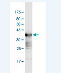 WNK2 Antibody (2A2), Novus Biologicals 0.1 mg; Unconjugated:Antibodies,