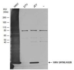 West Nile Virus NS2B Antibody, Novus Biologicals 100 &mu;g | Buy Online | Novus Biologicals | Fisher Scientific