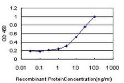 WRN Antibody (3C11), Novus Biologicals 0.1 mg | Buy Online | Novus Biologicals | Fisher Scientific