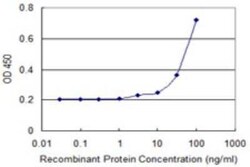 WSB1 Antibody (3E10), Novus Biologicals 0.1 mg | Buy Online | Novus Biologicals | Fisher Scientific