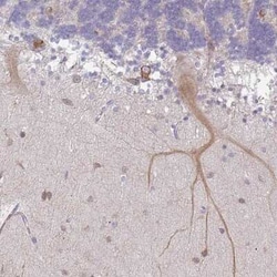WSB2 Antibody, Novus Biologicals:Antibodies:Primary Antibodies