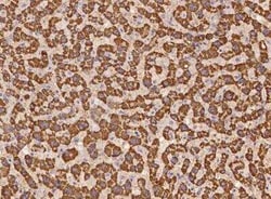 WSCD2 Antibody, Novus Biologicals 50 &mu;g; Unconjugated:Antibodies, Polyclonal