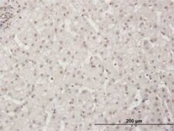 WSTF Antibody (5E9), Novus Biologicals 100 &mu;g | Buy Online | Novus Biologicals | Fisher Scientific