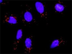 WSTF Antibody (5E9), Novus Biologicals 100 &mu;g | Buy Online | Novus Biologicals | Fisher Scientific