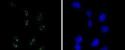 WT1 Antibody (SC06-41), R D Systems 100 &mu;L | Buy Online | R&D Systems | Fisher Scientific