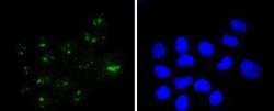 WT1 Antibody (SC06-41), R D Systems 100 &mu;L | Buy Online | R&D Systems | Fisher Scientific