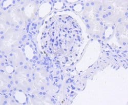 WT1 Antibody (SC06-41), R D Systems 100 &mu;L | Buy Online | R&D Systems | Fisher Scientific