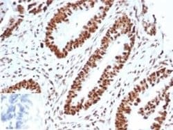 WT1 Rabbit anti-Human, Clone: WT1/3477R, Novus Biologicals:Antibodies:Primary
