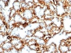WT1 Rabbit anti-Human, Clone: WT1/3477R, Novus Biologicals:Antibodies:Primary