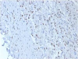 WT1 Antibody (SPM361), Novus Biologicals 0.1mg; Unlabeled:Antibodies, Monoclonal