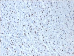 WT1 Antibody (WT1/857 + 6F-H2), Novus Biologicals 0.02mg; Unlabeled:Antibodies,