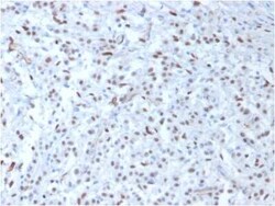 WT1 Antibody (WT1/857), Novus Biologicals 0.02mg; Unlabeled:Antibodies,