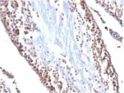 WT1 Antibody (WT1/857), Novus Biologicals 0.02mg; Unlabeled:Antibodies,